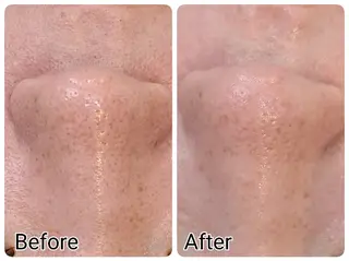 Hisui 種村のエステ・リラクイメージ