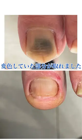 メンズ ネイル Chérinail 爪のお手入れのネイルデザイン