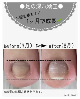 ネイル nail salon petillantのネイルデザイン