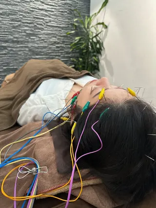 小顔矯/美容鍼/鍼灸 BeauJuのその他イメージ