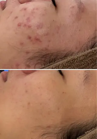 美時雨・bishigure所属・美時雨 bishigureのエステ・リラクイメージ