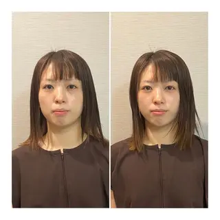 即小顔♥️美容鍼× ハーブピーリングのその他イメージ