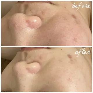 メンズ メナード岐阜市茜部 杉浦のエステ・リラクイメージ