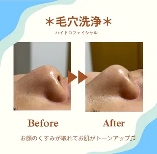 White labo 今村のエステ・リラクイメージ