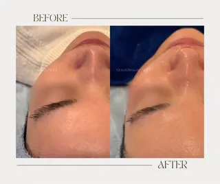 艶肌ワックス ALLY.のエステ・リラクイメージ