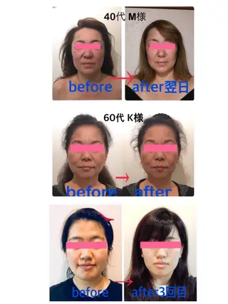 小顔矯正＆ロミロミ ラハイナ所属・小顔矯正 ラハイナのエステ・リラクイメージ