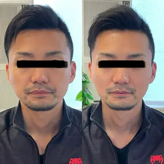 マッツンの 鍼のその他イメージ