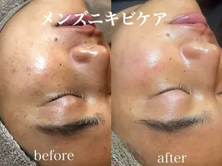 肌管理サロン neoriiのその他イメージ