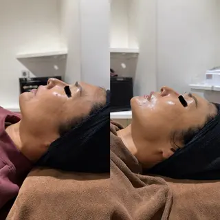 ニキビケア専門サロン Unityのエステ・リラクイメージ