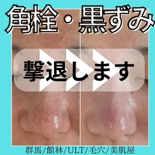 ULT ultimateskin所属・ULT ウルトのエステ・リラクイメージ