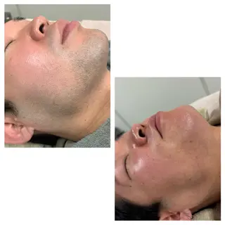 メンズ MISEREL岡崎店 Ayaのエステ・リラクイメージ