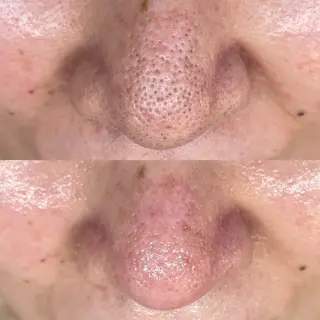 毛穴専門店MeMe.八千代店所属・毛穴・頭皮 専門店💪のその他イメージ