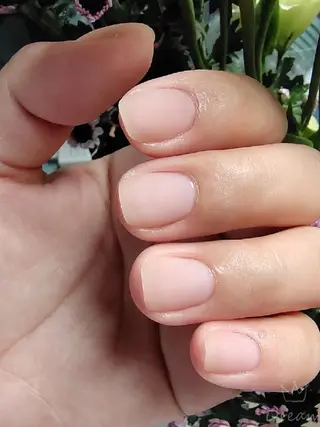 ネイル フィルイン・深爪矯正 長さ出し🎀のネイルデザイン