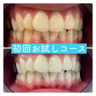 ホワイトニングルーム 横浜店のその他イメージ