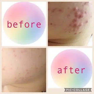 ミディアム カラー パーマ ヘアアレンジ メンズ キッズ ネイル マツエク・マツパ ニキビ・肌質改善専門 ♡人生が変わるサロンのエステ・リラクイメージ