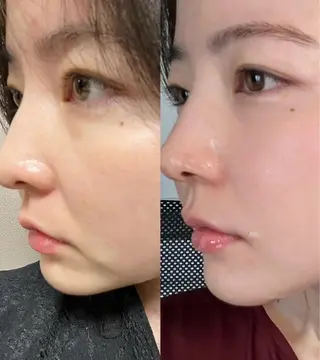 マツエク・マツパ 愛維美水光美肌専門店 メンズレディースokのエステ・リラクイメージ