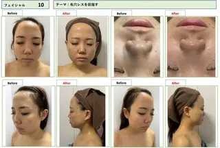 U24限定クーポン レイビス池袋MANAのエステ・リラクイメージ