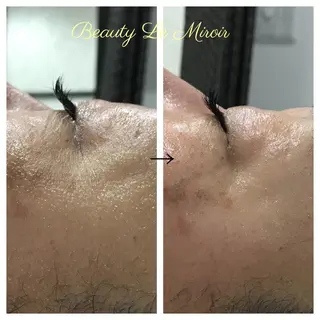 ビューティー ミロワールのエステ・リラクイメージ