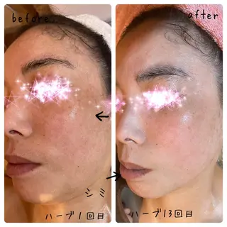 fairyrose organicエステのエステ・リラクイメージ