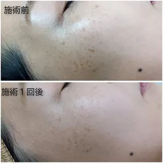 シミケア専門店 HAQUAのエステ・リラクイメージ