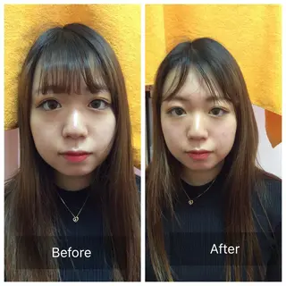 美容鍼×小顔矯正× 美容整体/小林幸司のエステ・リラクイメージ