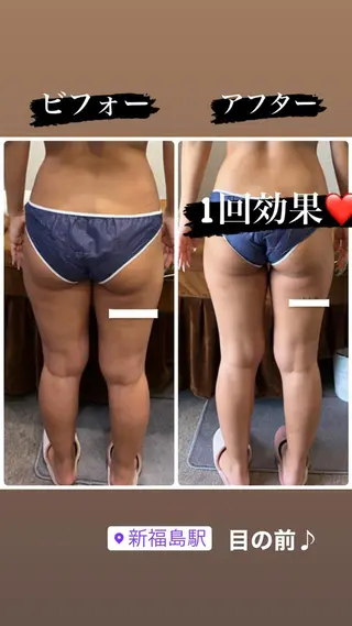 FLEUR 2号店のエステ・リラクイメージ