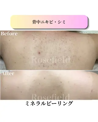 ローズフィールド 森岡朋美のエステ・リラクイメージ