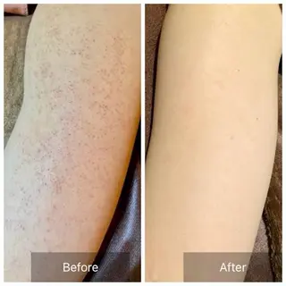 医療提携Ruby小顔 ハーブピーリング加藤のエステ・リラクイメージ