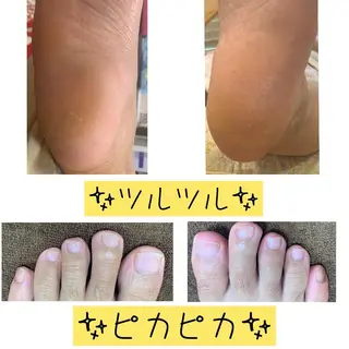 carenail　 tsugumiのその他イメージ