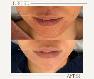 艶肌ワックス ALLY.のエステ・リラクイメージ