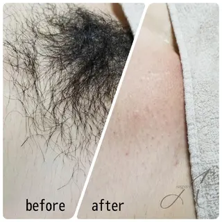マツエク・マツパ ネイル キッズ ヘアアレンジ パーマ カラー ショート A*《エースター》 シュガーリング🍋のエステ・リラクイメージ