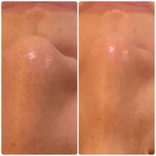 Relama/リラマ 美容鍼×マッサージのエステ・リラクイメージ