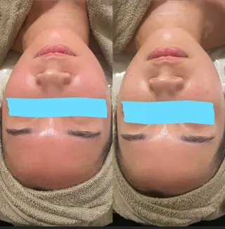 中目黒ハーブピーリン グ🌿ララピールのエステ・リラクイメージ