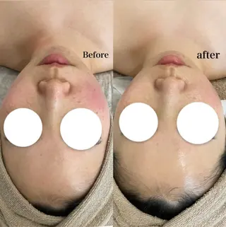 MISEL  2nd所属・主島 葉月のエステ・リラクイメージ