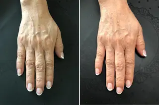 ネイル BELTA NAILのネイルデザイン
