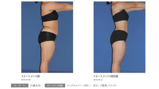 オレンジバナナ 新潟店のエステ・リラクイメージ