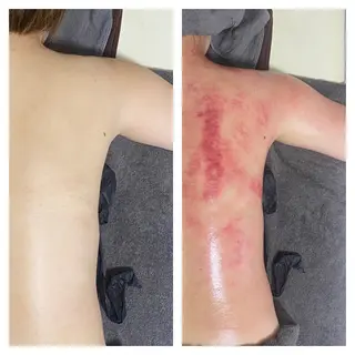 セルライトクラッシュ ＆腸もみ＋骨盤矯正のその他イメージ