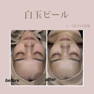 🌈Linora🌈 レイビス 永石のエステ・リラクイメージ