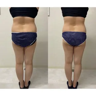 B againのエステ・リラクイメージ