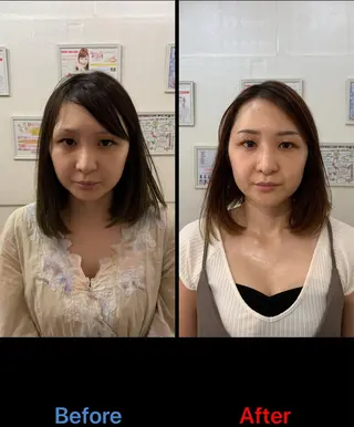 毛穴改善/脱毛 ネイル　川上久仁子のエステ・リラクイメージ