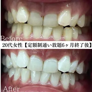 キッズ メンズ セルフホワイトニング WHITE福岡天神店のエステ・リラクイメージ