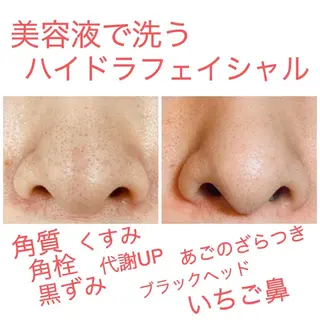 プリート毛穴洗浄美肌 Pulitoのエステ・リラクイメージ