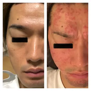 肌質を変えて すっぴん肌に✨のその他イメージ