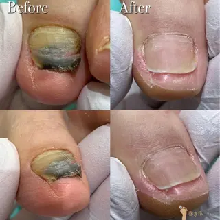 巻き爪アカデミー 溝の口のネイルデザイン