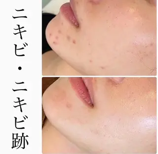 ハーブピーリング専門 BIOPLUS+川崎のエステ・リラクイメージ
