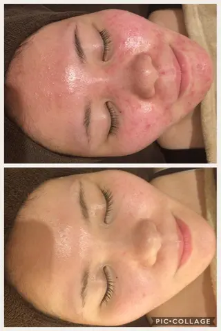 ショート カラー パーマ ヘアアレンジ メンズ キッズ ネイル マツエク・マツパ ニキビ・肌質改善専門 ♡人生が変わるサロンのエステ・リラクイメージ