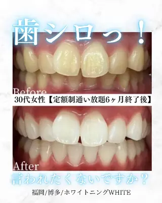 キッズ メンズ セルフホワイトニング WHITE福岡博多店のエステ・リラクイメージ