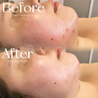 Sui Eye & Beautyのマツエク・マツパデザイン