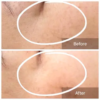 ガレリア エステ 名駅所属・シオダ チコトのエステ・リラクイメージ