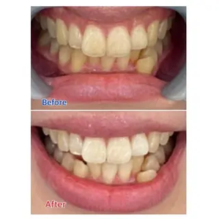 Ｍ渋谷 ホワイトニングのエステ・リラクイメージ